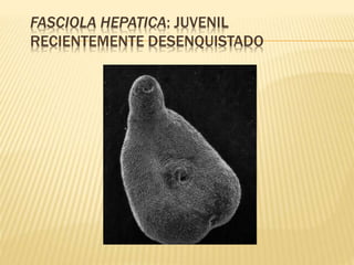 FASCIOLA HEPATICA: JUVENIL 
RECIENTEMENTE DESENQUISTADO 
 