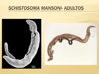 SCHISTOSOMA MANSONI- ADULTOS 
 