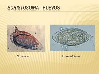 SCHISTOSOMA - HUEVOS 
S. mansoni S. haematobium 
 