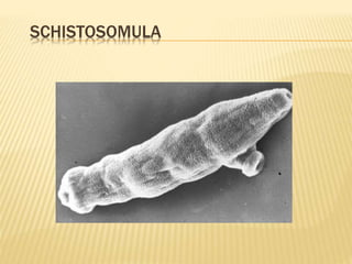 SCHISTOSOMULA 
 