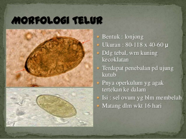 101+ Gambar Telur Cacing Paragonimus Westermani HD 101+ Gambar Telur Cacing Paragonimus Westermani HD