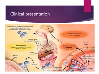 Clinical presentation
 