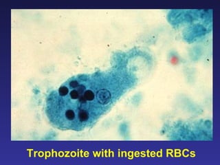 Trophozoite with ingested RBCs 
