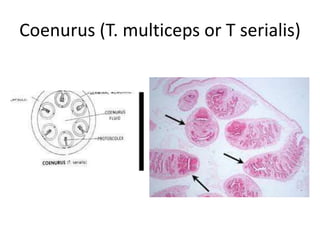 Parasitology-images for neet pgs and ugs | PPTX