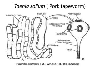 Taenia solium ( Pork tapeworm)
 
