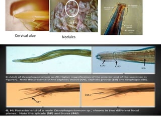 Cervical alae Nodules
 