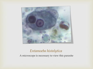 Entamoeba histolytica
A microscope is necessary to view this parasite
 