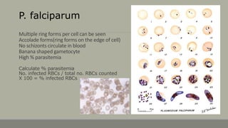 Comprehensive Laboratory Diagnosis and Clinical Overview of Parasitic ...