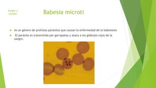 Babesia microti 
Sangre y 
tejidos 
 es un género de protistas parásitos que causan la enfermedad de la babesiosis 
 El parásito es transmitido por garrapatas y ataca a los glóbulos rojos de la 
sangre. 
 