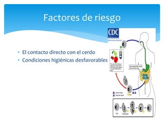  El contacto directo con el cerdo
 Condiciones higiénicas desfavorables
Factores de riesgo
 