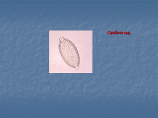 Capillaria spp.
 
