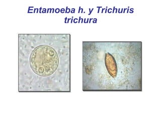 Entamoeba h. y Trichuris trichura 