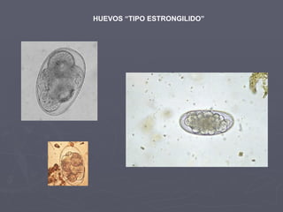 HUEVOS “TIPO ESTRONGILIDO” 