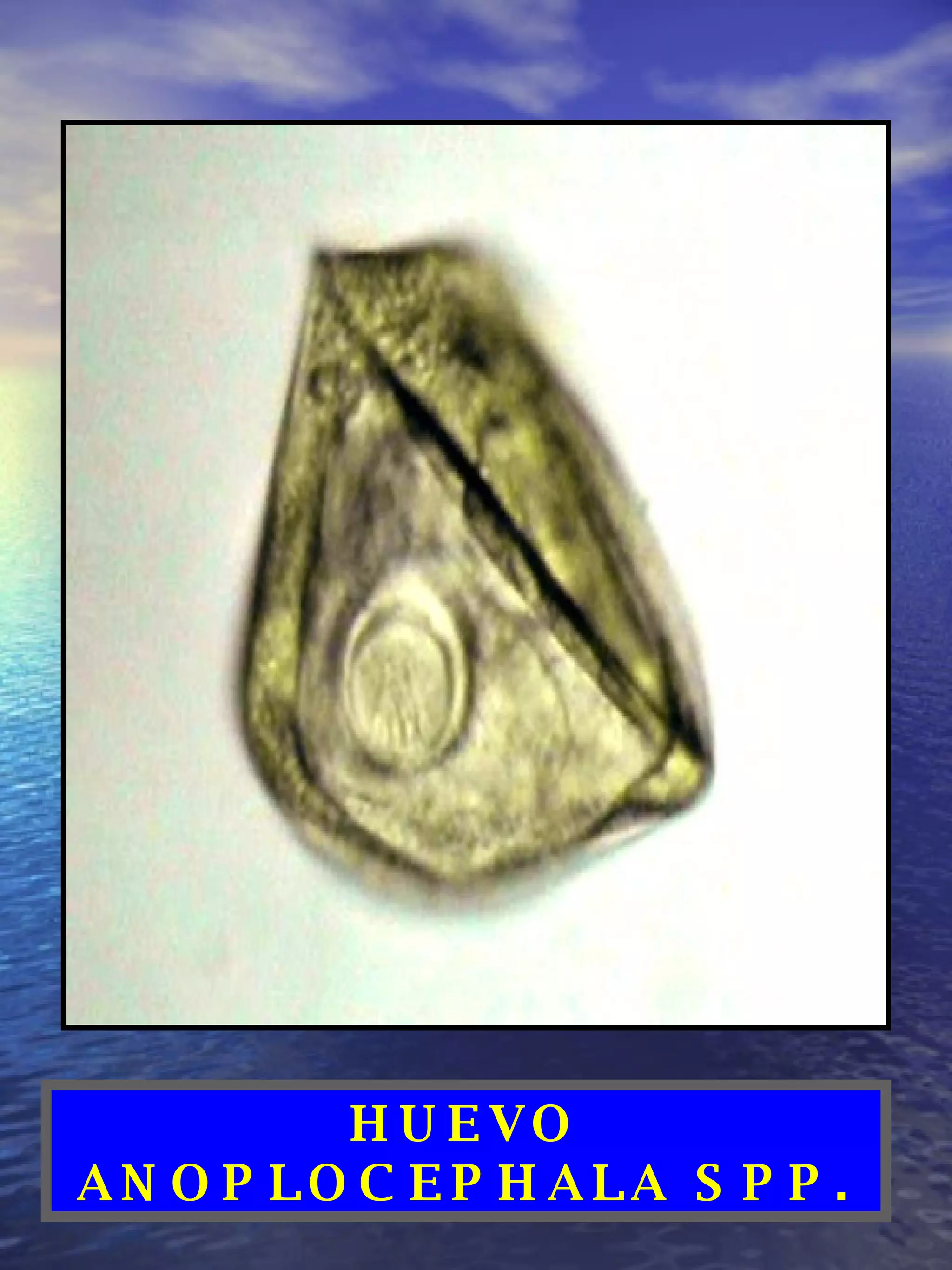 HUEVO ANOPLOCEPHALA SPP.