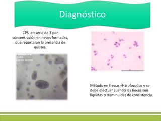 Diagnóstico
CPS en serie de 3 por
concentración en heces formadas,
que reportarán la presencia de
quistes.
Método en fresco  trofozoítos y se
debe efectuar cuando las heces son
líquidas o disminuidas de consistencia.
 