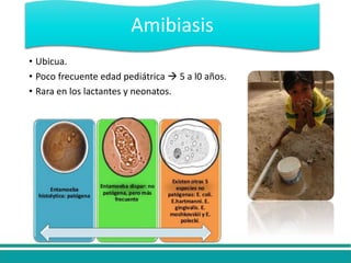 • Ubicua.
• Poco frecuente edad pediátrica  5 a l0 años.
• Rara en los lactantes y neonatos.
Amibiasis
 