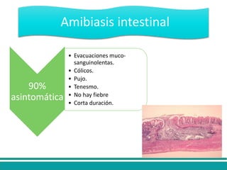90%
asintomática
• Evacuaciones muco-
sanguinolentas.
• Cólicos.
• Pujo.
• Tenesmo.
• No hay fiebre
• Corta duración.
Amibiasis intestinal
 