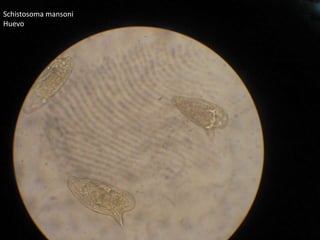 Schistosomamansoni Huevo 