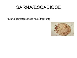 SARNA/ESCABIOSE
•É uma dermatozoonose muito frequente
 