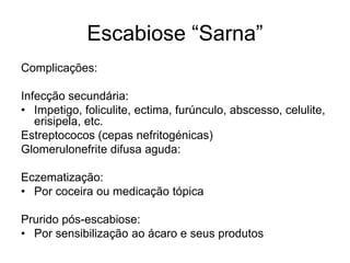 Escabiose “Sarna”
Complicações:
Infecção secundária:
• Impetigo, foliculite, ectima, furúnculo, abscesso, celulite,
erisipela, etc.
Estreptococos (cepas nefritogénicas)
Glomerulonefrite difusa aguda:
Eczematização:
• Por coceira ou medicação tópica
Prurido pós-escabiose:
• Por sensibilização ao ácaro e seus produtos
 