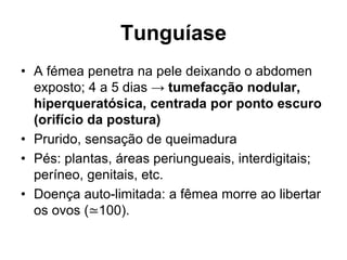 Tunguíase
• A fémea penetra na pele deixando o abdomen
exposto; 4 a 5 dias → tumefacção nodular,
hiperqueratósica, centrada por ponto escuro
(orifício da postura)
• Prurido, sensação de queimadura
• Pés: plantas, áreas periungueais, interdigitais;
períneo, genitais, etc.
• Doença auto-limitada: a fêmea morre ao libertar
os ovos (≃100).
 