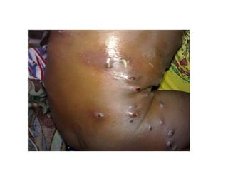 ParasitosesDeformaResumida.finalissima.ppt