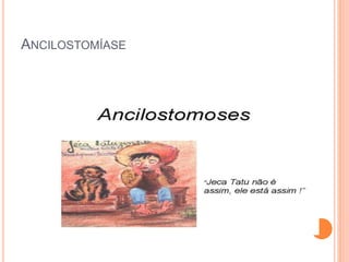 ANCILOSTOMÍASE
 