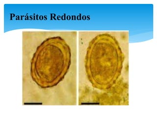 Parásitos Redondos
 
