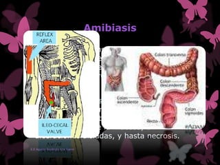Amibiasis
 Padecimiento transmisible, muy frecuente
en zonas tropicales y templadas,
producida por la entamoeba hystolitica,
protozoario del grupo de los rizópodos.
 Su localización es en el colon: área
íleocecal, o en la rectosigmoidea, en
donde produce alteraciones inflamatorias
en los pliegues de la mucosa, o
ulceraciones aisladas, y hasta necrosis.
E.E Aguilar Reséndiz Ana Karen
 