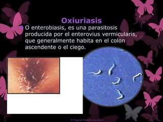 Oxiuriasis
 O enterobiasis, es una parasitosis
producida por el enterovius vermicularis,
que generalmente habita en el colon
ascendente o el ciego.
E.E Aguilar Reséndiz Ana Karen
 