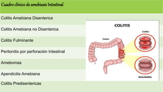 Cuadroclínico de amebiasis Intestinal
Colitis Amebiana Disenterica
Colitis Amebiana no Disenterica
Colitis Fulminante
Peritonitis por perforación Intestinal
Amebomas
Apendicitis Amebiana
Colitis Predisentericas
 