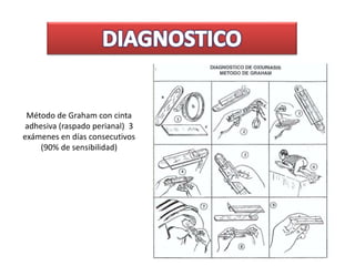 Método de Graham con cinta
adhesiva (raspado perianal) 3
exámenes en días consecutivos
(90% de sensibilidad)
 
