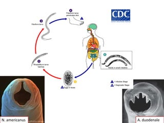 A. duodenaleN. americanus
 