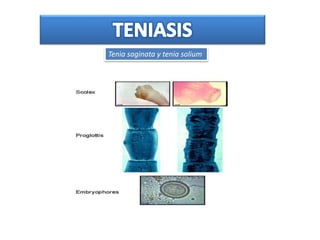 Tenia saginata y tenia solium
 