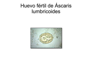 Huevo fértil de Áscaris lumbricoides 