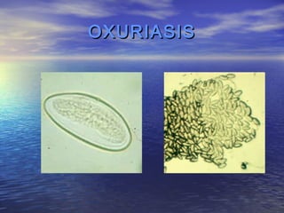 OXURIASIS
 