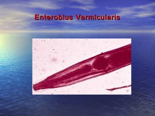 Enterobius Vermicularis
 
