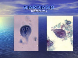 GIARDIASIS
  TROFOZOITOS
 