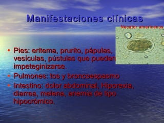Manifestaciones clínicas
                                     Necator americanus




• Pies: eritema, prurito, pápulas,
  vesículas, pústulas que pueden
  impeteginizarse.
• Pulmones: tos y broncoespasmo
• Intestino: dolor abdominal, Hiporexia,
  diarrea, melena, anemia de tipo
  hipocrómico.
 