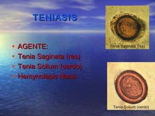 TENIASIS


•   AGENTE:                Tenia Saginata (res)

•   Tenia Saginata (res)
•   Tenia Solium (cerdo)
•   Hemynolepis Nana



                            Tenia Solium (cerdo)
 