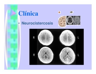 Parasitosis Intestinales Humanas