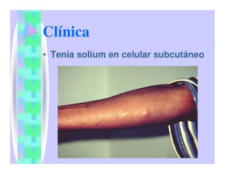 Parasitosis Intestinales Humanas