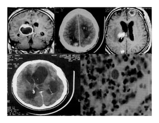 Parasitosis Intestinales Humanas