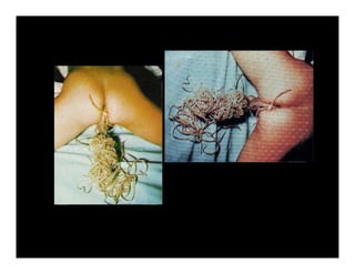 Parasitosis Intestinales Humanas