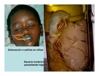 Parasitosis Intestinales Humanas