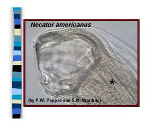 Parasitosis Intestinales Humanas