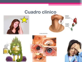 Cuadro clínico

 