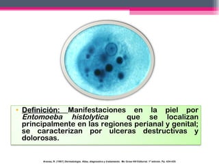 • Definición: Manifestaciones en la piel por
Entomoeba histolytica
que se localizan
principalmente en las regiones perianal y genital;
se caracterizan por ulceras destructivas y
dolorosas.
Arenas, R. (1987) Dermatología. Atlas, diagnostico y tratamiento. Mc Graw Hill Editorial. 1ª edición. Pp. 434-435

 