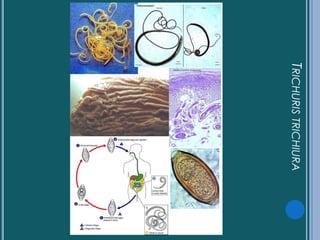CPHAP 019 Parasitosis en Pediatria