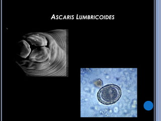 CPHAP 019 Parasitosis en Pediatria